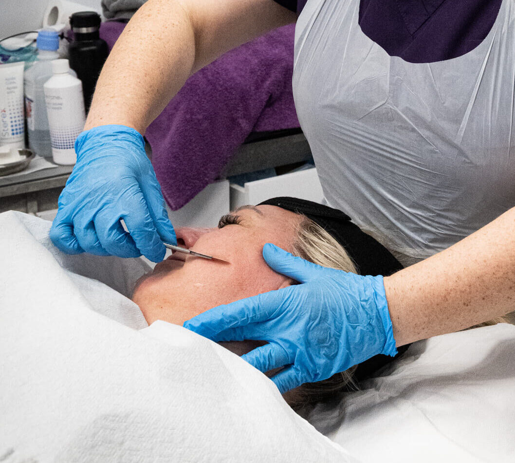 Dermaplane facial treatment at Reflexions Skin Clinic