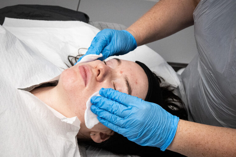 Professional facial skin treatment at Reflexions Skin Clinic