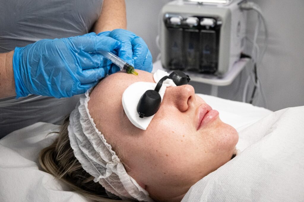 Chemical peel treatment at Reflexions Skin Clinic