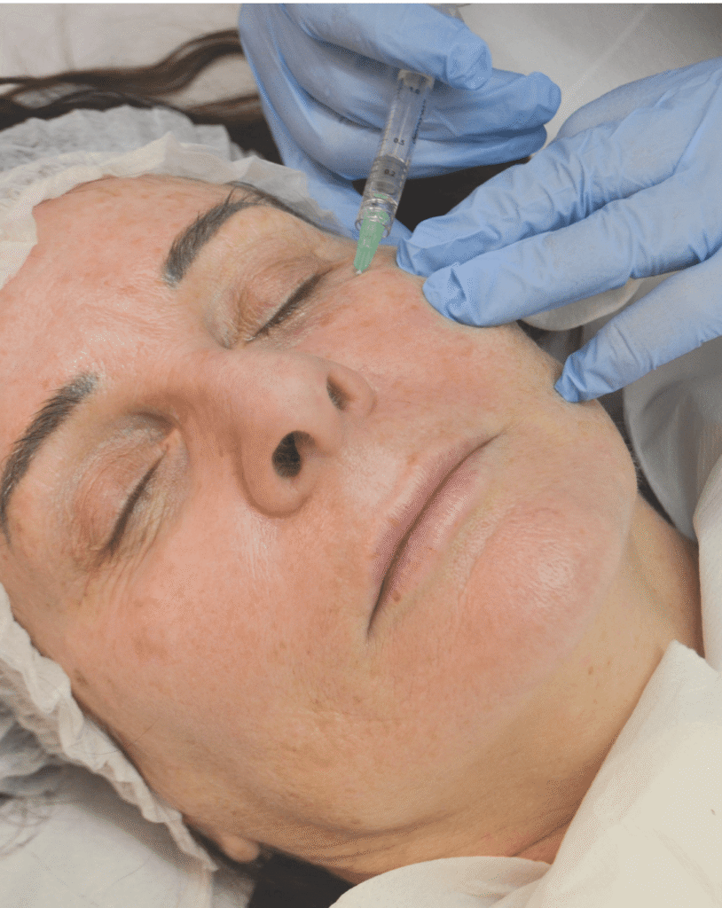 Skin booster and polynucleotide treatment at Reflexions