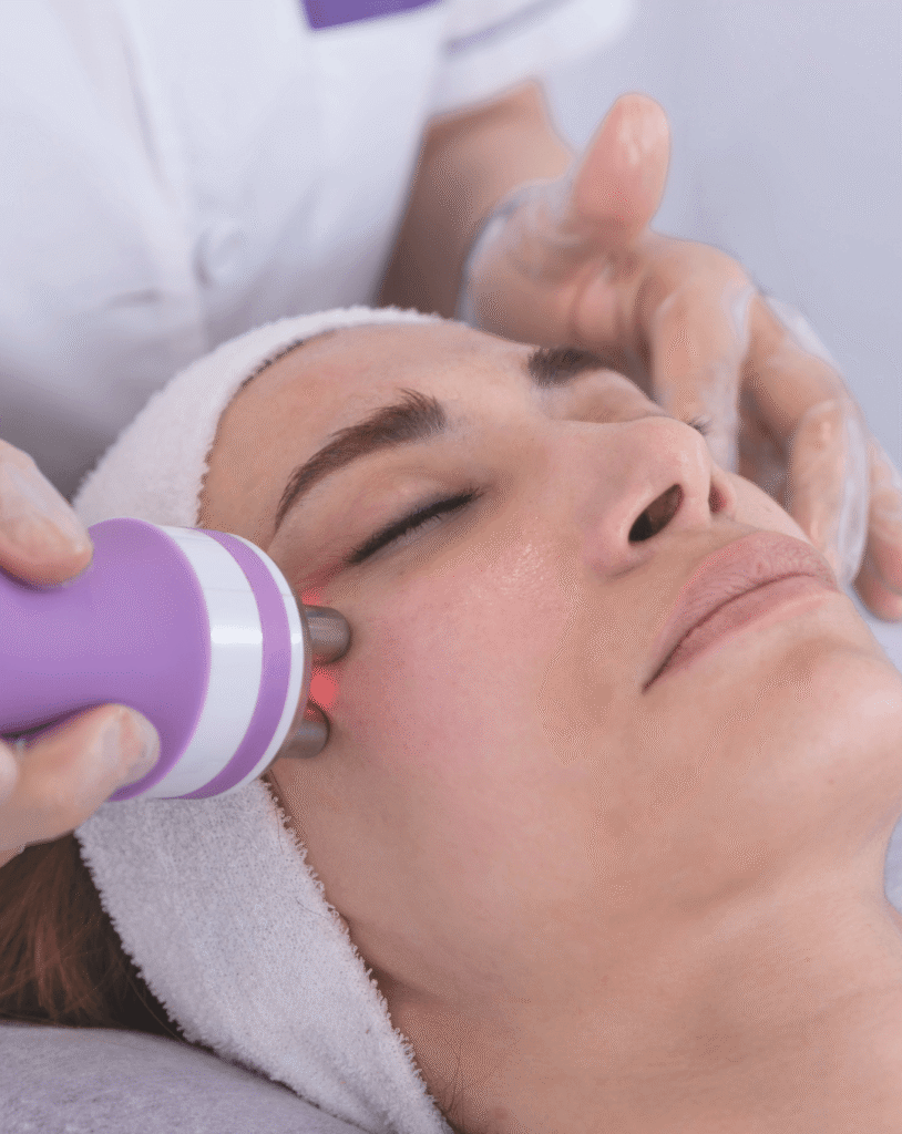 Radiofrequency skin treatment at Reflexions Skin Clinic