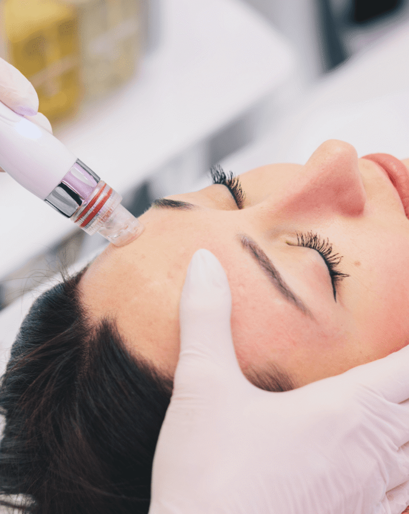 Hydradermabrasion facial treatment at Reflexions Skin Clinic